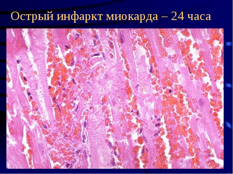 Ибс презентация патанатомия