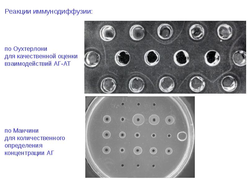 Радиальная иммунодиффузия по манчини презентация - 98 фото