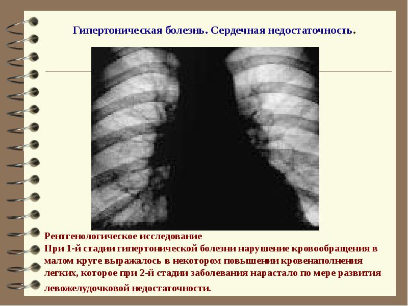 Лучевая диагностика сердечно сосудистой системы презентация