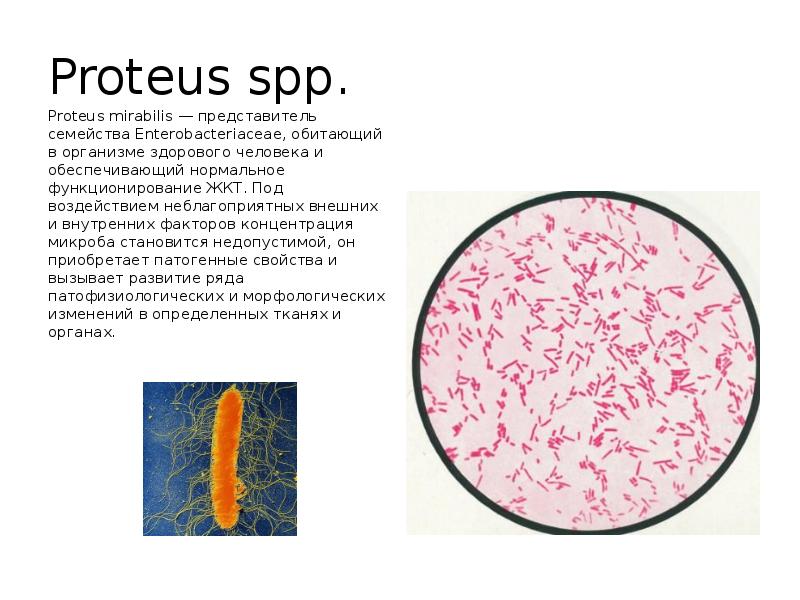 Бактерия spp. Бактерии рода Proteus (Протеус). Протеи энтеробактерии.