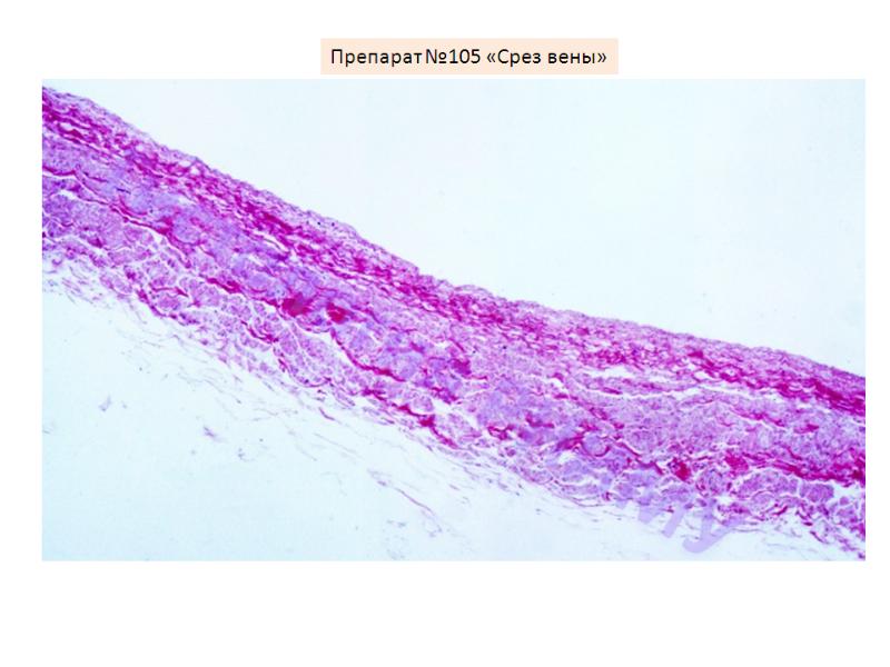 Сердечно сосудистая система гистология презентация