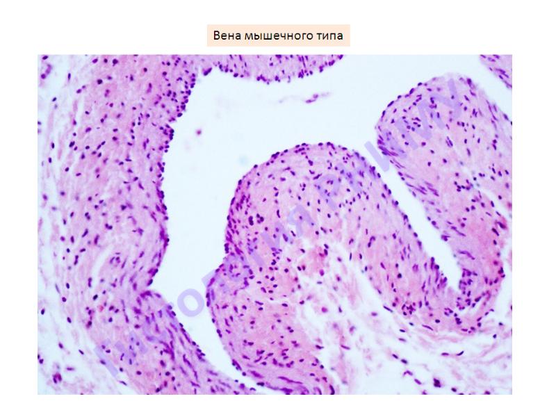 Вена препарат. Вена безмышечного типа гистология. Вена мышечного типа препарат гистология. Вена мышечного типа гистология. Вена безмышечного типа гистология препарат.