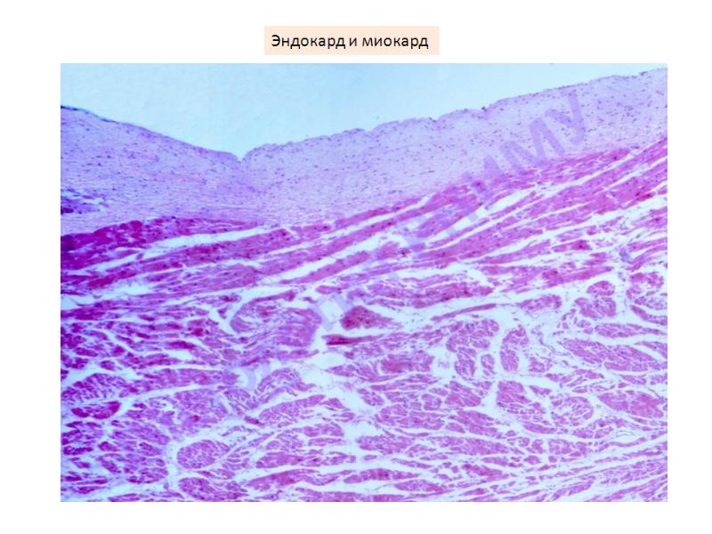 Сердце гистология презентация