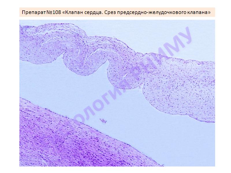 Клапан гистология. Вена гистология препарат. Строение клапанов сердца гистология. Клапан гистология. Митральный клапан гистология.