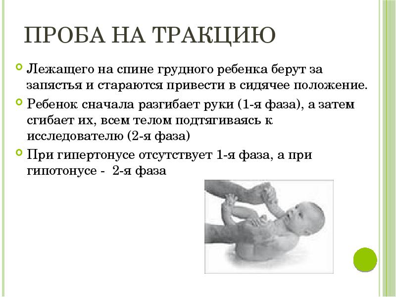 Гипотония у новорожденного