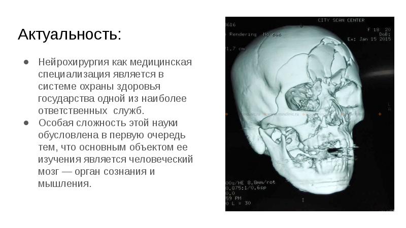 Презентации по нейрохирургии