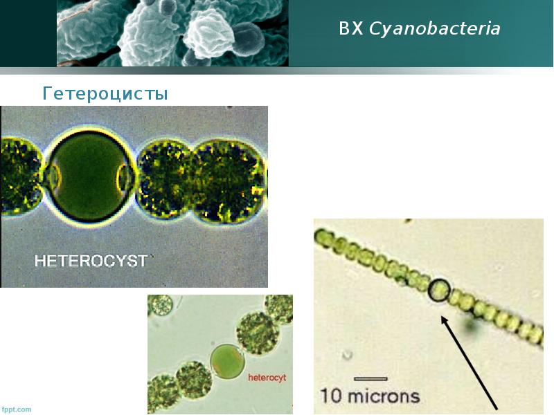 Цианобактерии гетероцисты. Цианобактерии азотфиксаторы. Носток гетероцисты. Anabaena гетероциста.