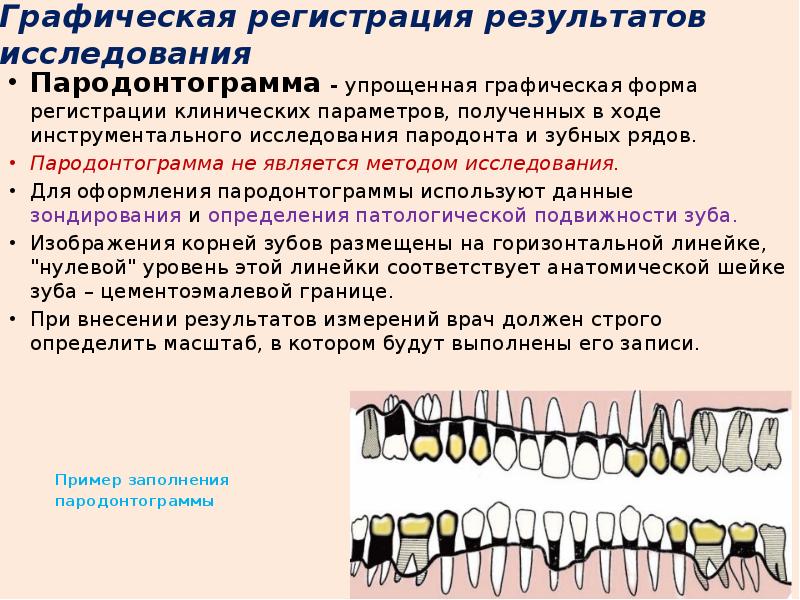 Средства лечения пародонтита