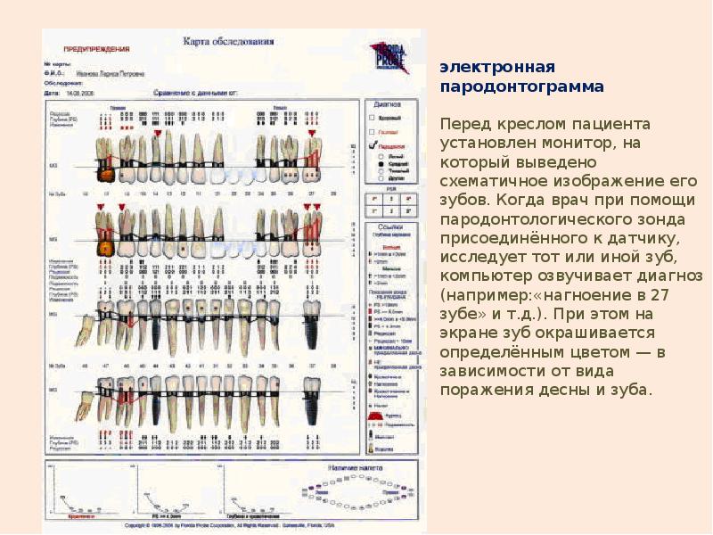 Карта исследования пародонта