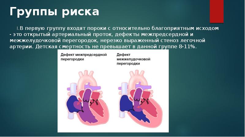 Операция межпредсердной перегородки. Межпредсердная перегородка дефект. Дефект межпредсердной перегородки. Гемодинамика при дефекте межпредсердной перегородки.