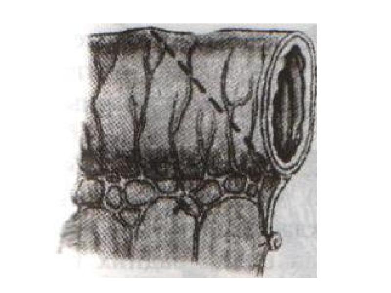 Кишечные швы топографическая анатомия презентация