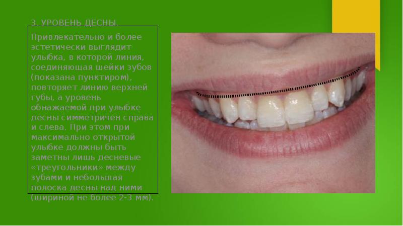 Презентация на тему феномен улыбки