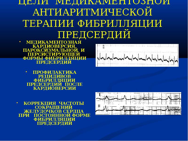 Аритмии презентация факультетская терапия