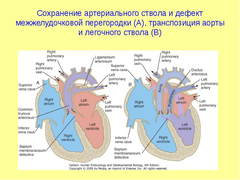 Общий артериальный ствол презентация