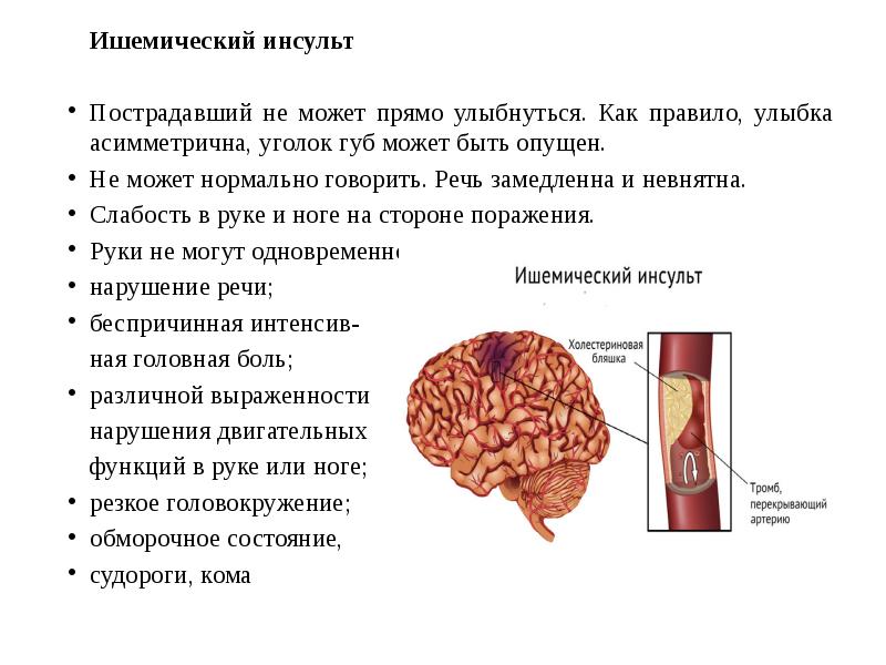 Острый ишемический инсульт клиническая картина