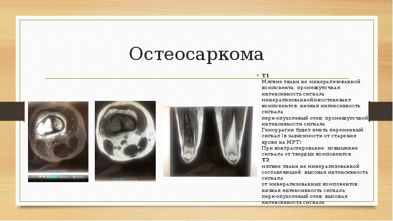 Режимы мрт презентация