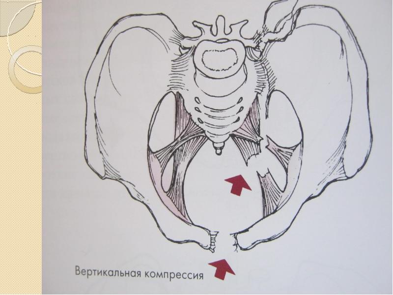 На столе лежит таз а в тазу лежит глаз