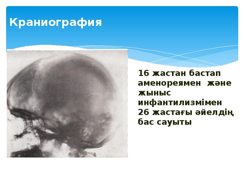 Краниография