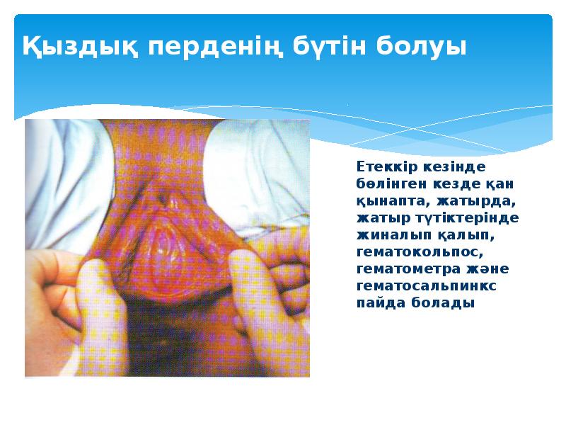 Қыздық перденің бүтін болуы