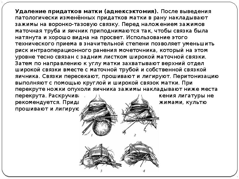 Основные виды гинекологических операций презентация