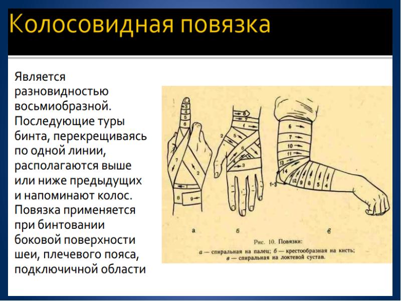 Перевязка определение