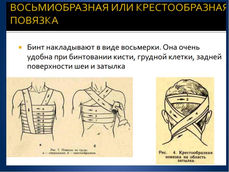 Как долго делать перевязки. Виды перевязок. Хирургические перевязки. Перевязка трахеостомы.