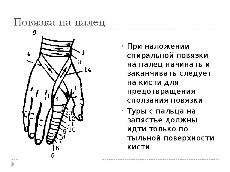 Бинтование перчатка схема