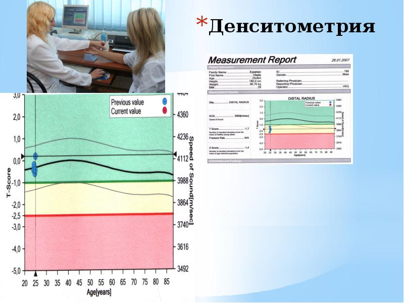 Денситометрия критерии. Денситометрия. Рентгеновская денситометрия. Денситометрия Результаты. Денситометрия заключение.