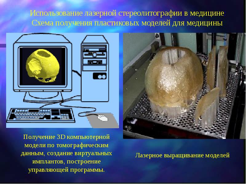 Лазерные технологии презентация