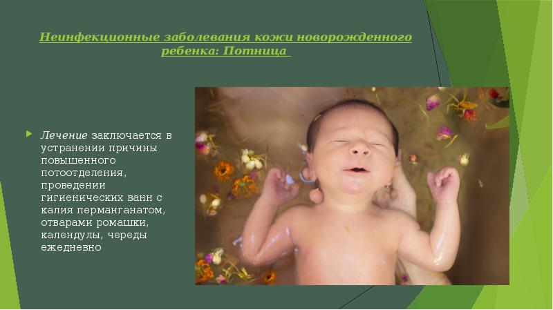 Нэк у новорожденных презентация