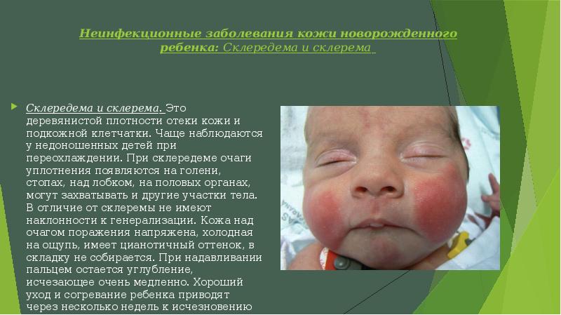 Кожные заболевания у детей дошкольного возраста таблица фото