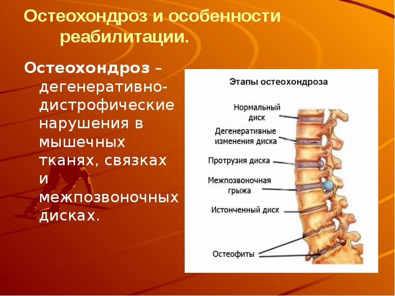 Дегенеративные заболевания позвоночника презентация