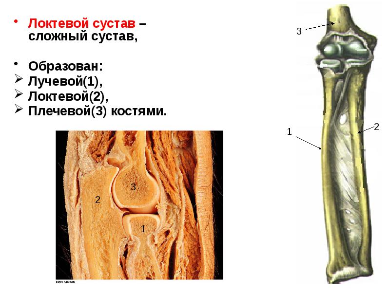 Сустав образован костями. Плечелоктевой сустав образован. Кости образующие локтевой сустав. Локтевой сустав образован сочленением костей. Скелет локтевого сустава.