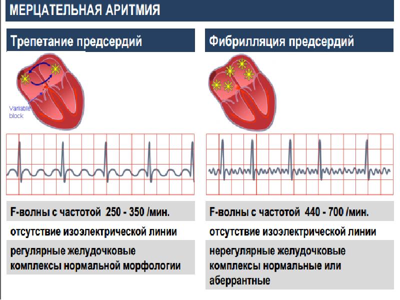 Продолжительность сердечного