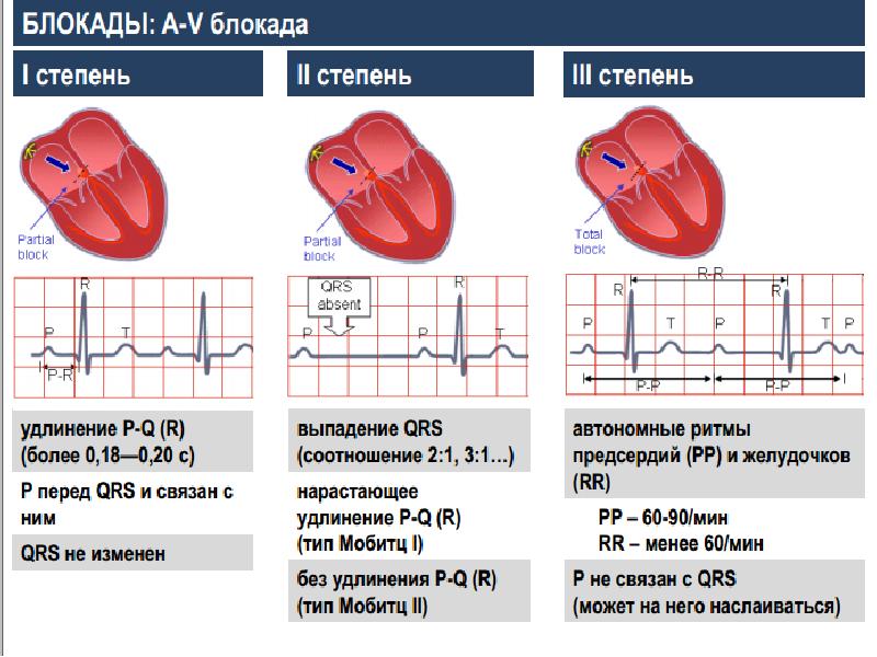 фетальный допплер bf 500++. анализатор допплеровский малогабаритный адмп-02. анализатор допплеровский малогабаритный адмп-02. анализатор сердечной деятельности.