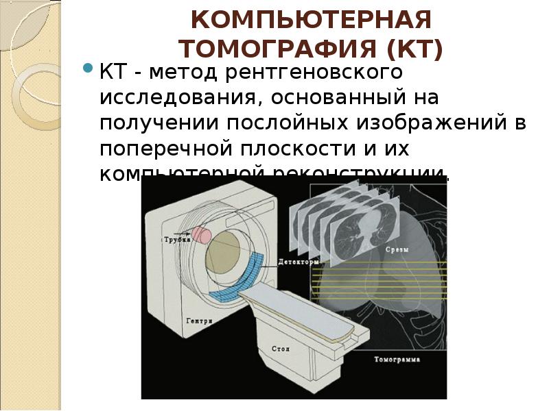 Компьютерная томография презентация