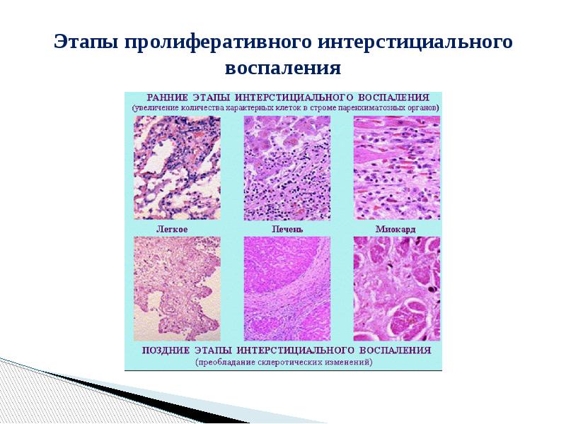 Воспаление патанатомия презентация