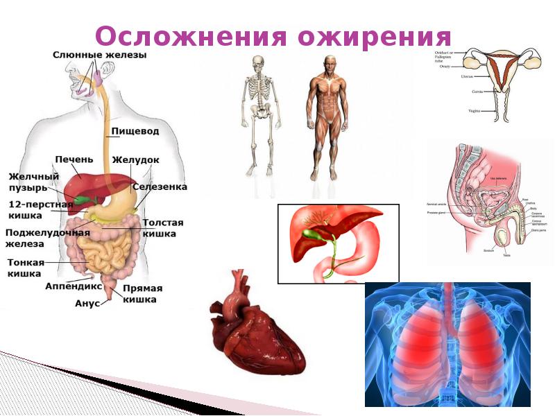 исход ожирения