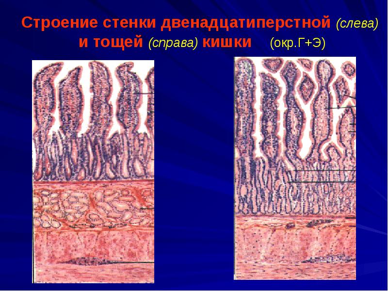 Строение стенки двенадцатиперстной кишки