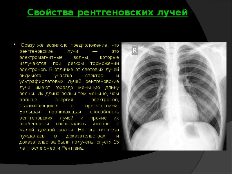 Ренгенное излучение презентация