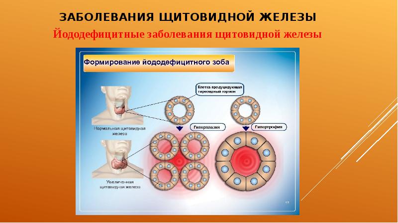 Презентация на тему заболевания щитовидной железы