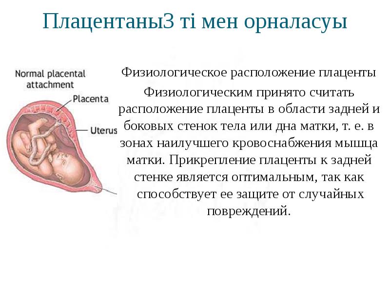 Фото плацента по задней стенке матки