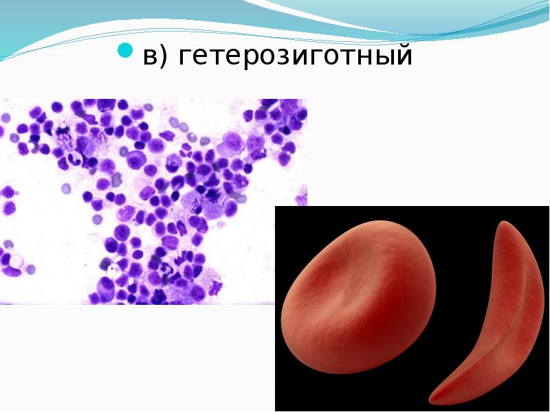 в) гетерозиготный  в) гетерозиготный