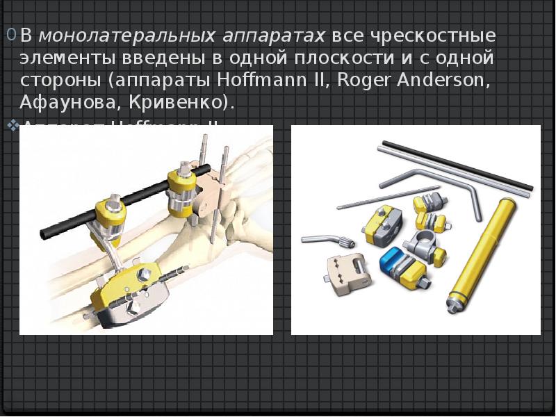 Внеочаговый остеосинтез презентация