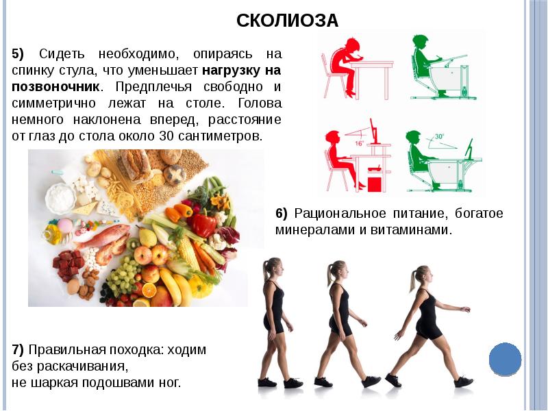 Профилактика сколиоза презентация