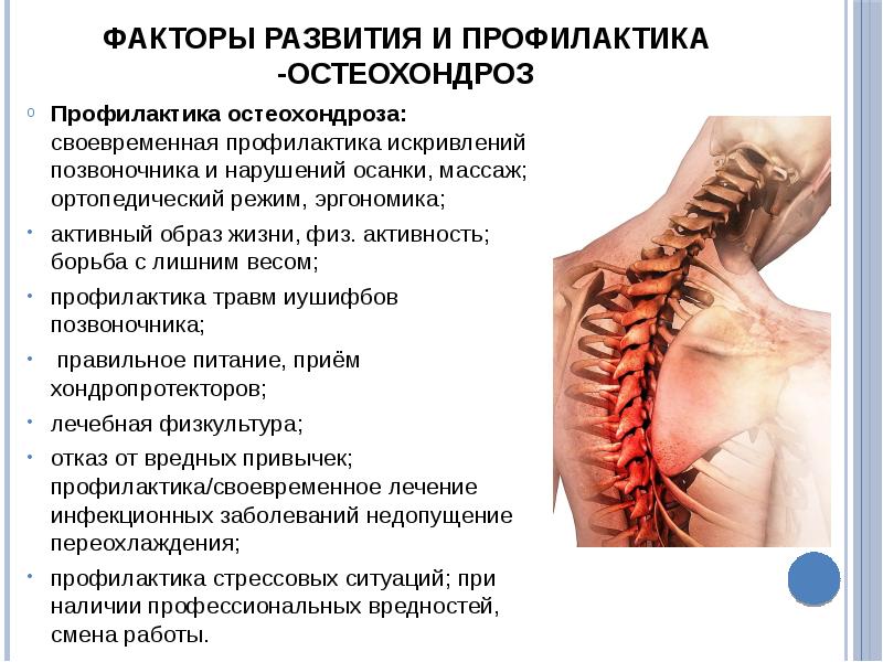 Презентация остеохондроз шейного отдела позвоночника