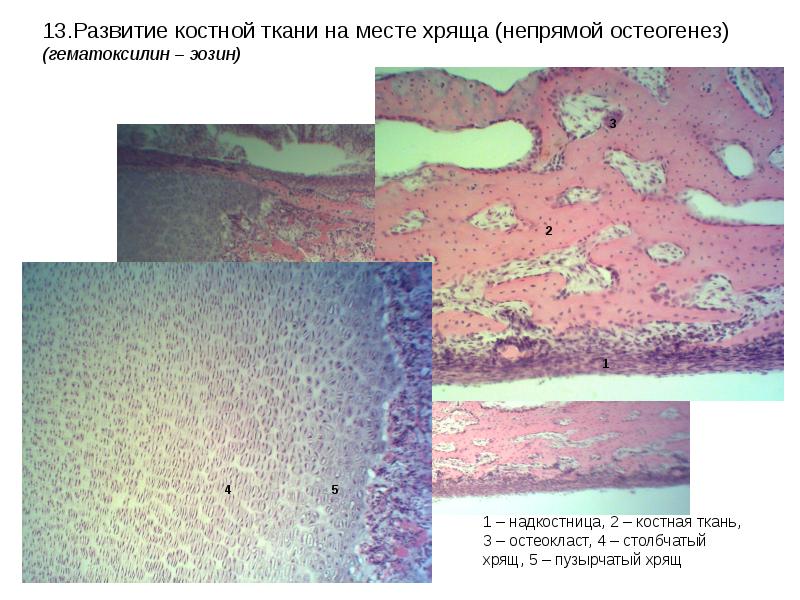 Развитие кости на месте хряща рисунок