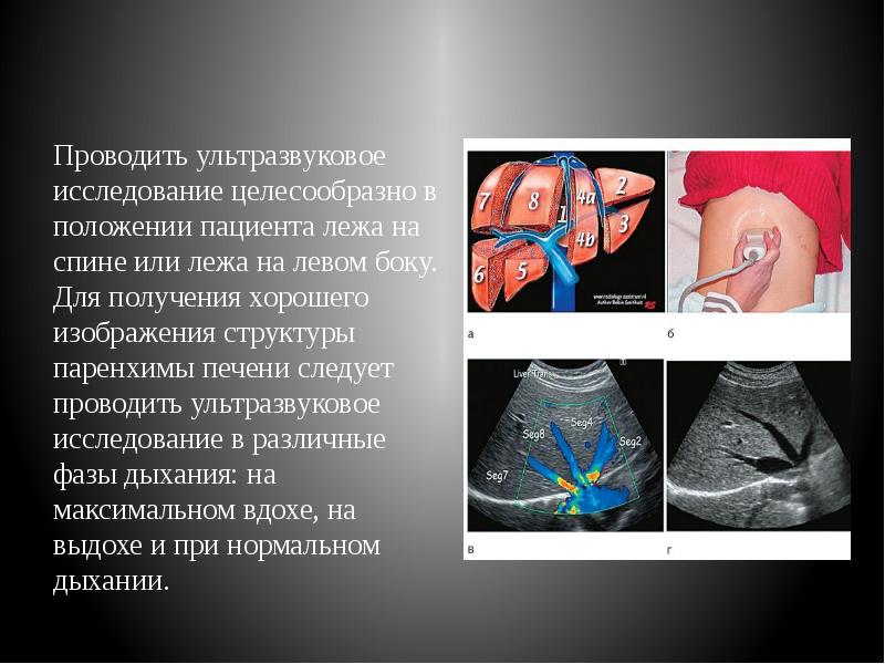 Проводить ультразвуковое исследование целесообразно в положении пациента лежа на спине или