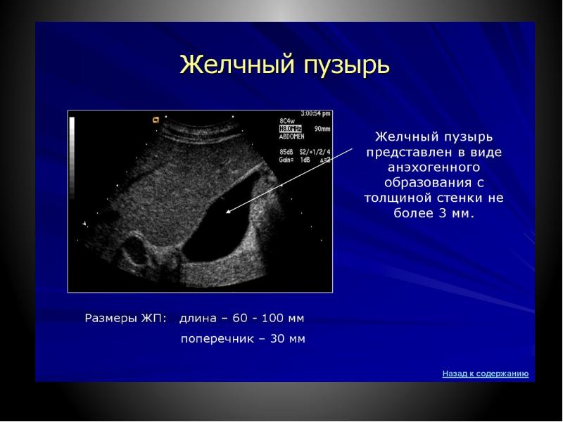 Направление на узи органов брюшной полости образец