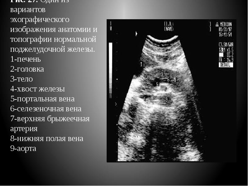 УЗИ органов брюшной полости. Ультразвуковая анатомия
